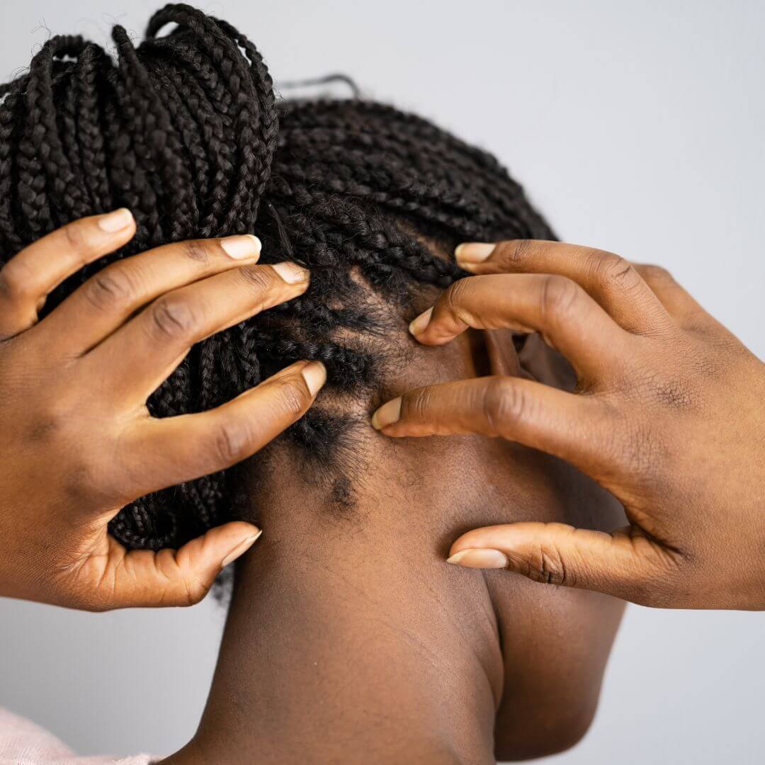 How to Improve Scalp Health Naturally: Beyond Basics for Real Results - woman massaging scalp for health.